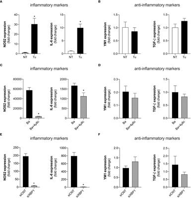 The endoplasmic reticulum stress sensor IRE1α modulates macrophage metabolic function during Brucella abortus infection